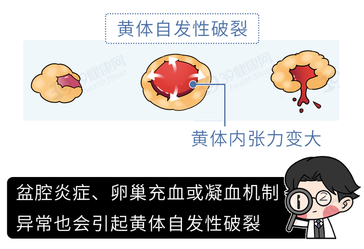 玩闹过度引发的警示，夫妻玩闹致妻子黄体破裂_反馈记录和整理