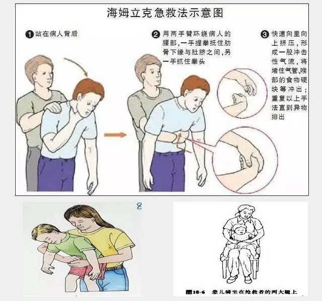 用海姆立克法救妈妈_反馈调整和优化