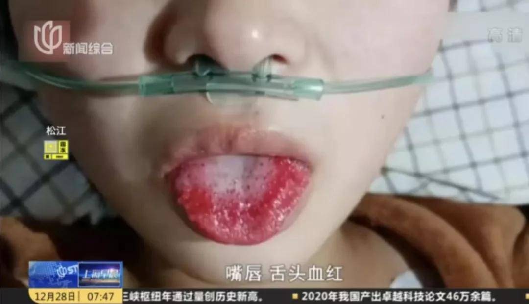 女子没感冒却持续流涕，揭示脑脊液的重要性与奥秘_解答解释