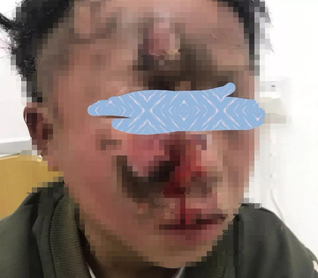 男子当街点烟花失误被炸身亡，监控视频曝光引发社会关注_细化方案和措施