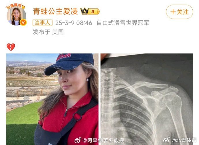 震惊！谷爱凌骨折X光曝光，背后的故事令人动容！_逐步落实和执行