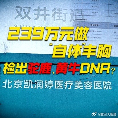 花巨款自体丰胸却检出黄牛驼鹿DNA，真相究竟如何？揭秘背后惊人内幕！_逐步落实和执行